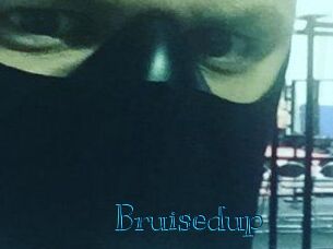 Bruisedup