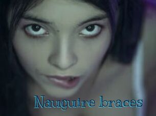 Nauguire_braces
